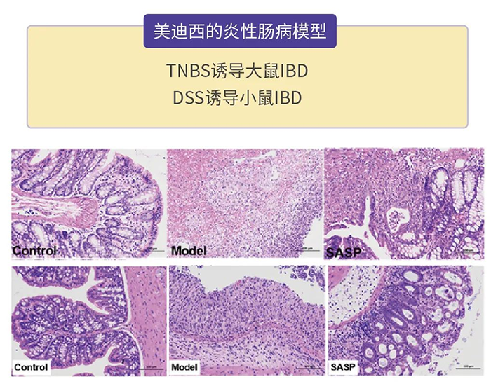 z6尊龙的炎性肠病模型.png z6尊龙的炎性肠病模型.png